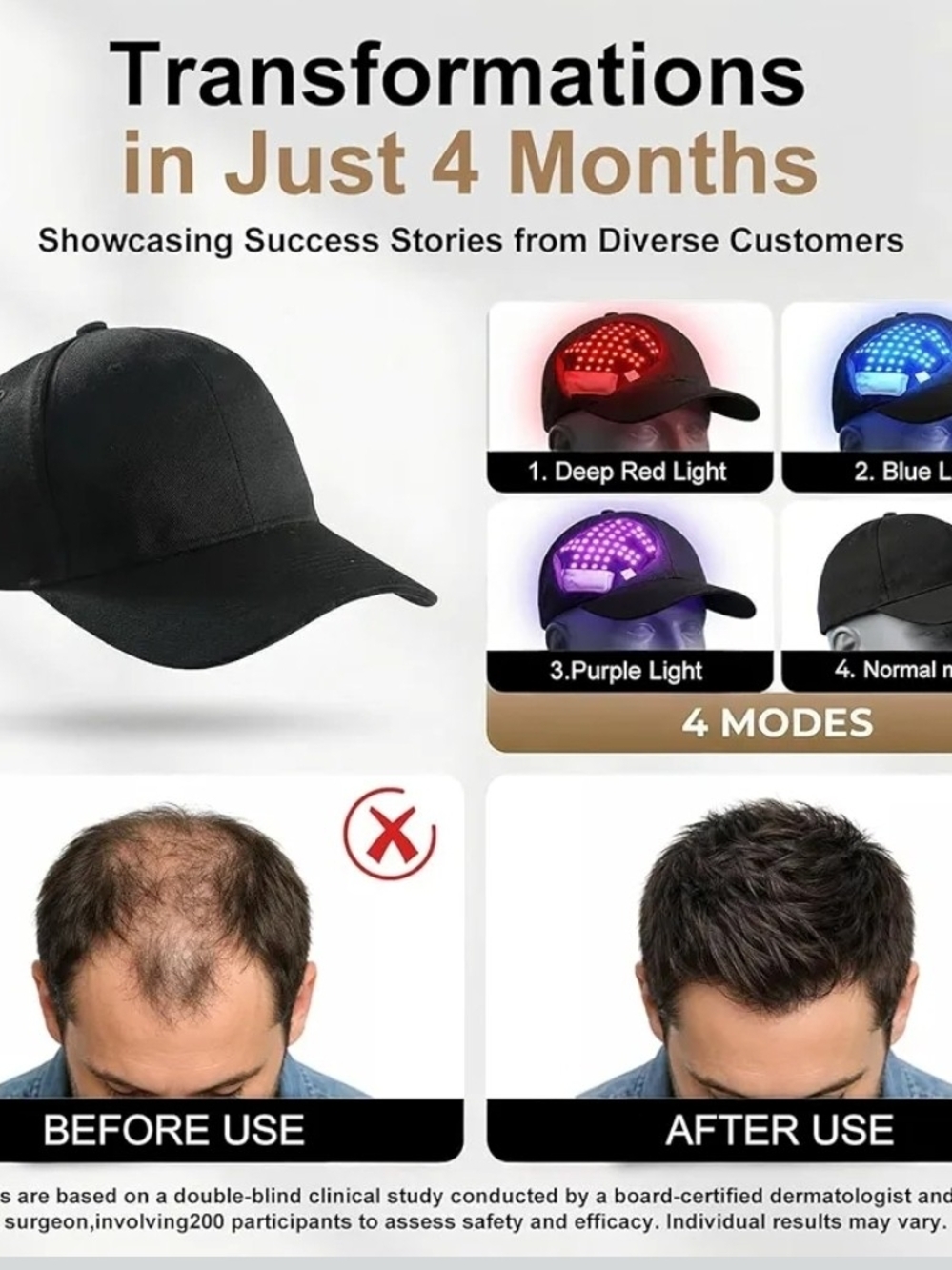 LED Therapy Hair Regrowth - Picture 5 of 5